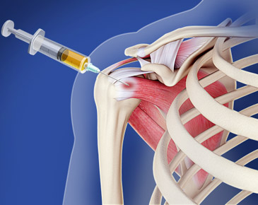 Orthopedic Surgeon in Yeshwanthpur